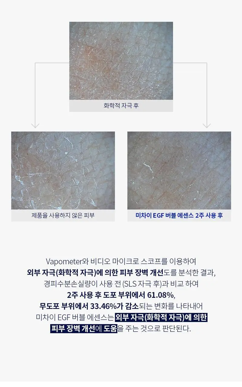 [쿨링/보습/흔적케어] 미차이 EGF 버블 에센스 230ML 상세페이지 22
